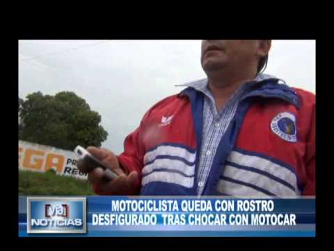 Motociclista queda con el rostro desfigurado tras chocar con Motocar Motociclista queda con el rostro desfigurado tras chocar con Motocar