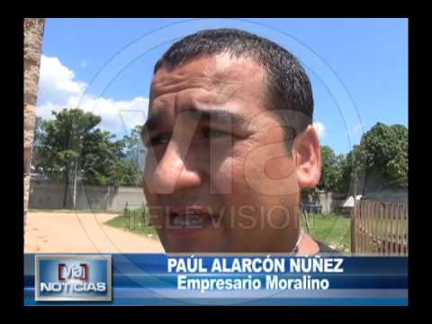 Niño con hidrocefalia necesita apoyo solidario