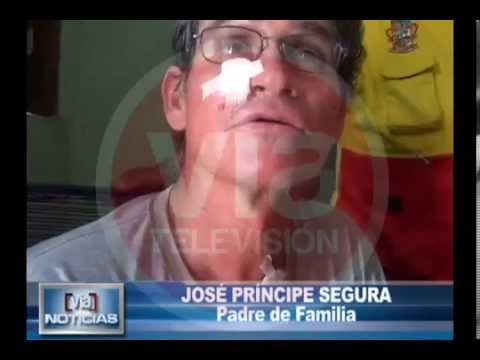 Entregan apoyo a hombre que fue operado de cáncer a la piel Entregan apoyo a hombre que fue operado de cáncer a la piel