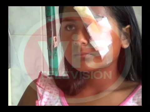 Adolescente se corta la cara con motosierra mientras ayudaba a su padre Adolescente se corta la cara con motosierra mientras ayudaba a su padre