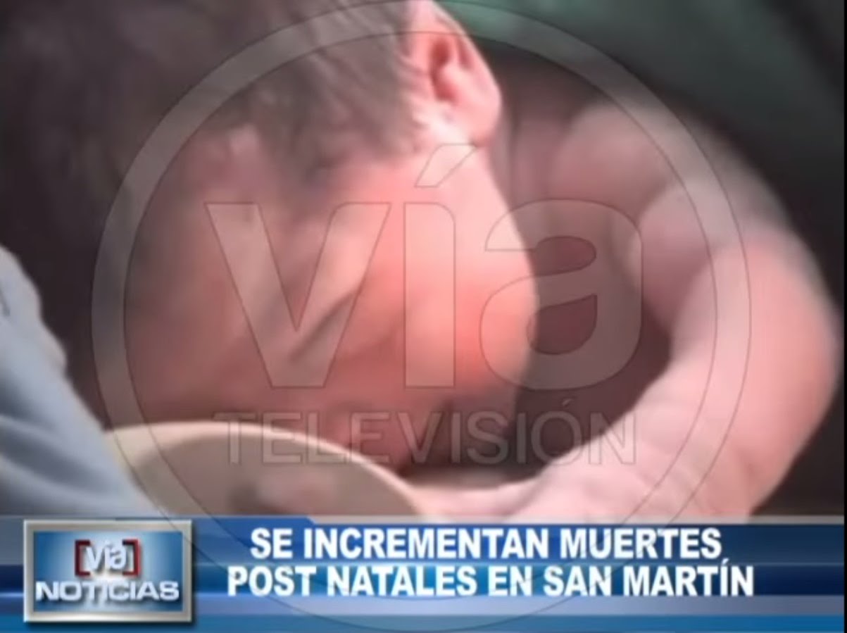Se incrementan muertes natales en San Martín Se incrementan muertes natales en San Martín