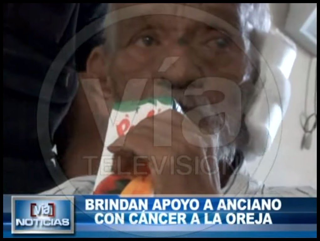 Brindan apoyo a anciano con cáncer a la oreja Brindan apoyo a anciano con cáncer a la oreja
