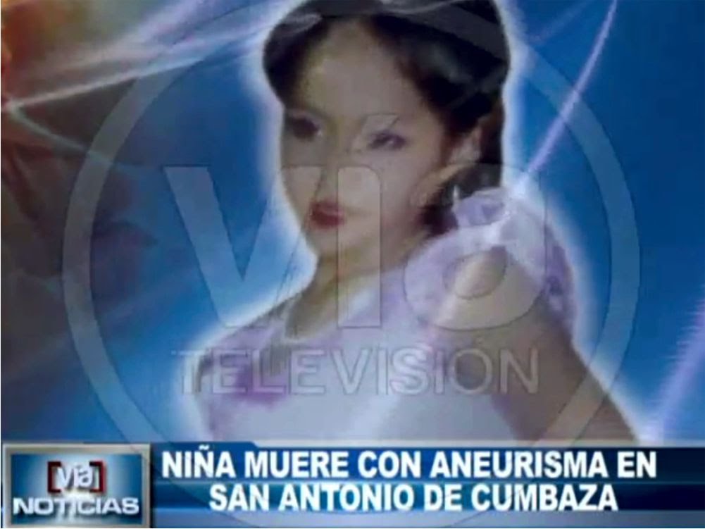 Niña de 10 año muere con aneurisma cerebral en San Antonio de Cumbaza Niña de 10 año muere con aneurisma cerebral en San Antonio de Cumbaza