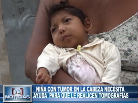 Niña con tumor en la cabeza necesita ayuda para realizarse tomografías Niña con tumor en la cabeza necesita ayuda para realizarse tomografías