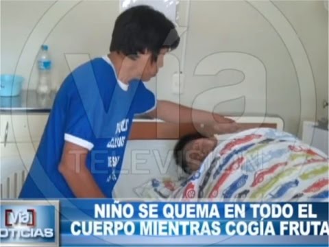 Niño se quema en todo el cuerpo mientras cogía frutas Niño se quema en todo el cuerpo mientras cogía frutas