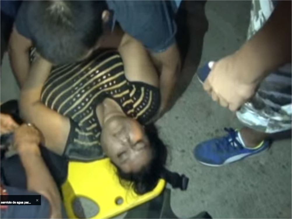 Tarapoto: Accidente entre moticletas deja una mujer herida Tarapoto: Accidente entre moticletas deja una mujer herida