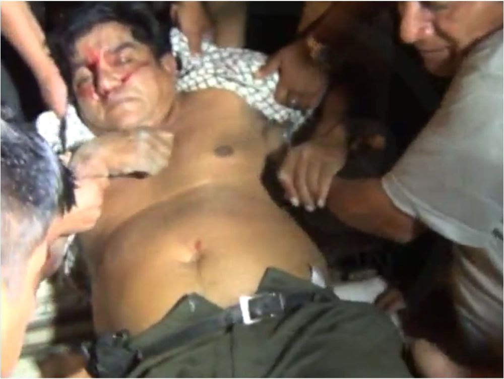 La Banda de Shilcayo: Accidente de tránsito deja una persona herida La Banda de Shilcayo: Accidente de tránsito deja una persona herida