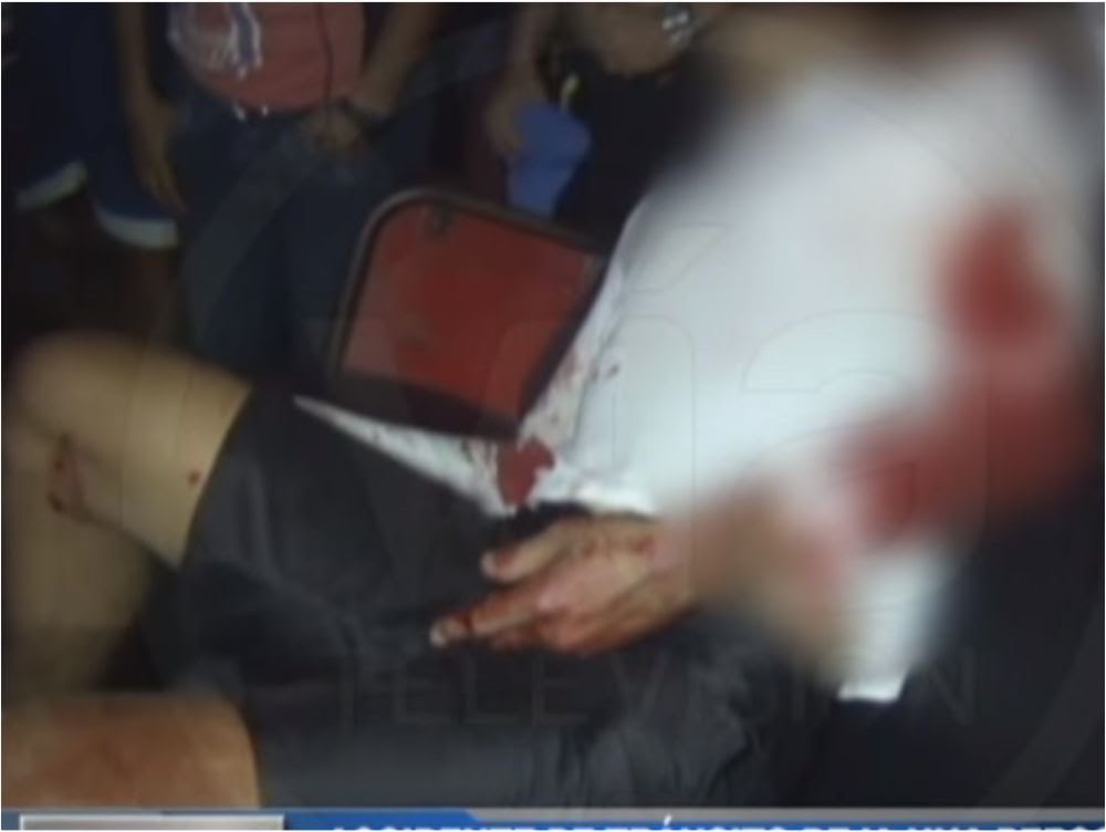 La Banda de Shilcayo: Accidente de tránsito deja una persona gravemente herida La Banda de Shilcayo: Accidente de tránsito deja una persona gravemente herida