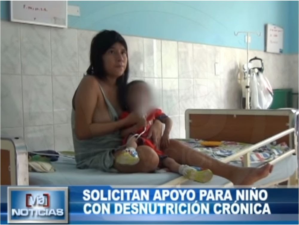 Salud: Solicitan apoyo para niño con desnutrición crónica Salud: Solicitan apoyo para niño con desnutrición crónica