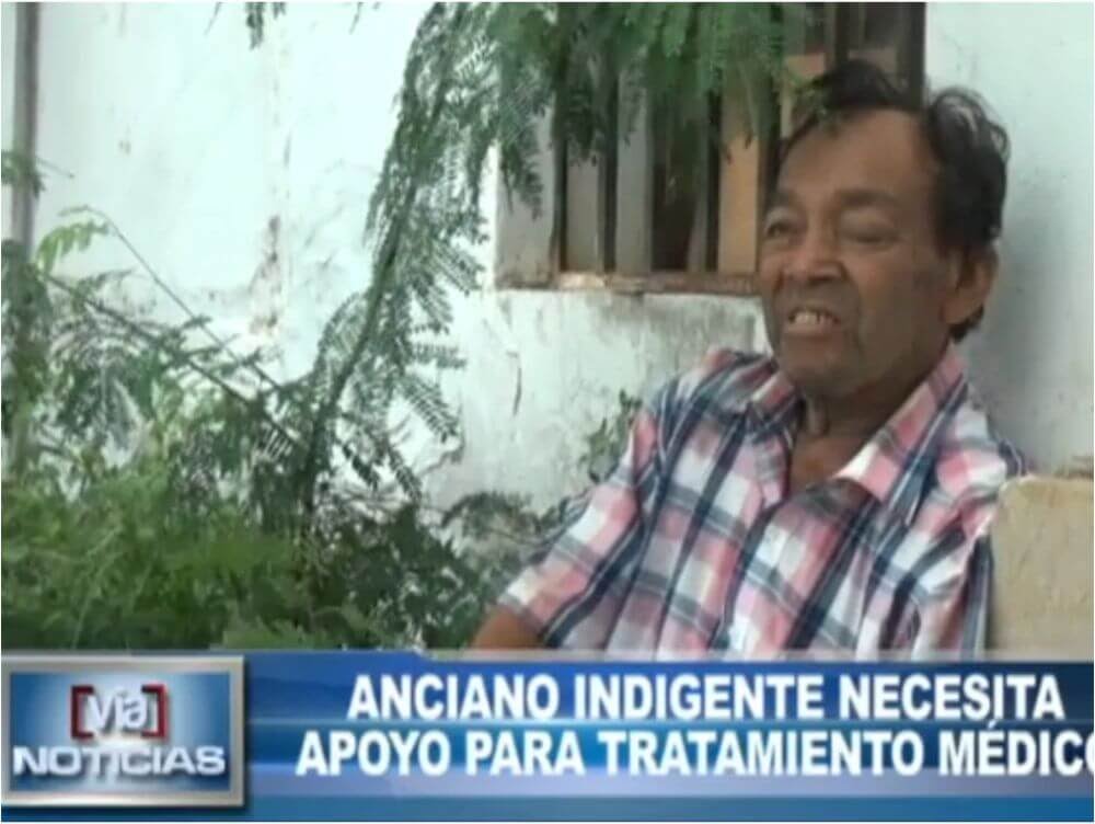 Tarapoto: Anciano indigente necesita apoyo para tratamiento médico Tarapoto: Anciano indigente necesita apoyo para tratamiento médico