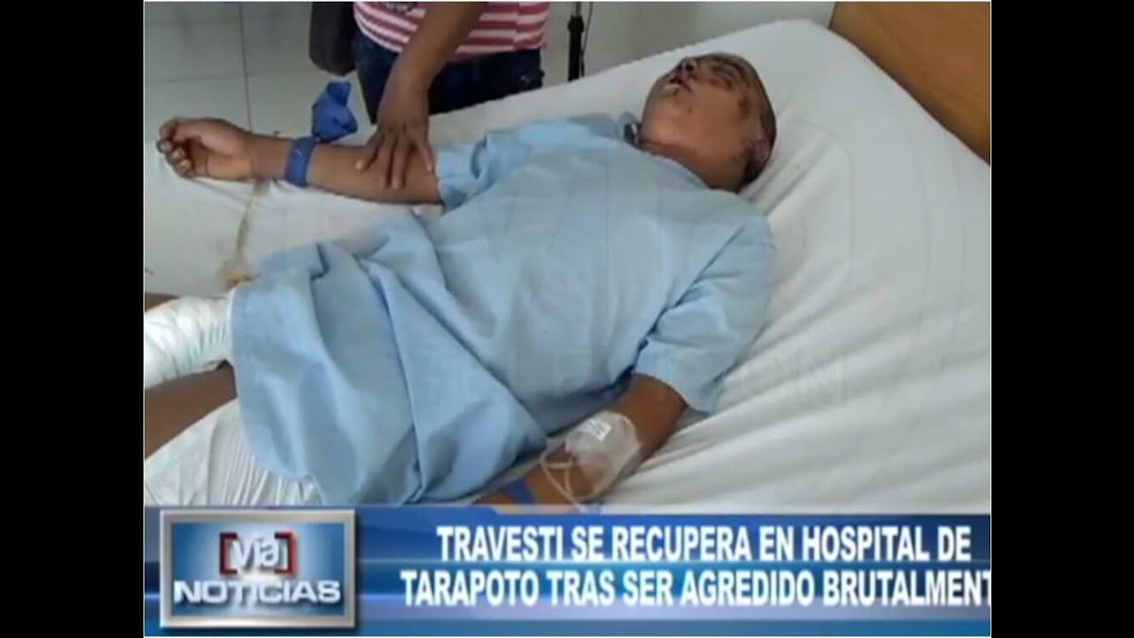 Travesti se recupera en hospital de Tarapoto tras ser agredido brutalmente Travesti se recupera en hospital de Tarapoto tras ser agredido brutalmente