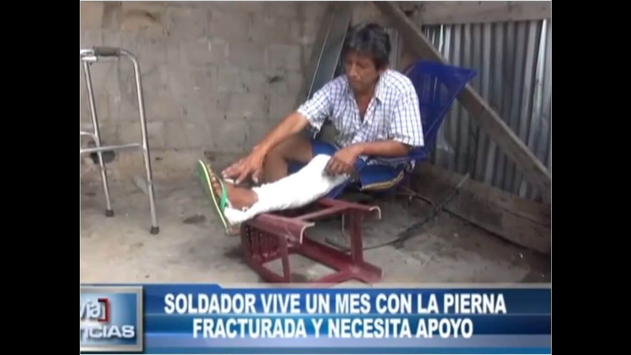Soldador vive un mes con la pierna fracturada y necesita apoyo