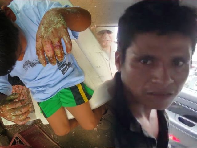 Detienen a hombre sindicado de quemar las manos de su hijo de 7 años