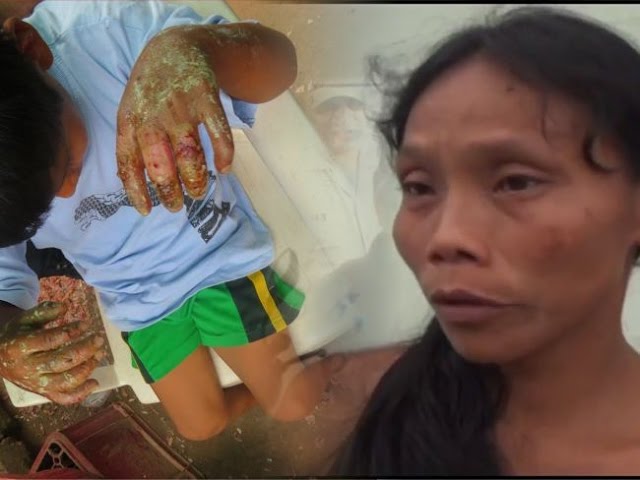 #Morales. Madre de niño que fue quemado revela que su esposo es muy violento