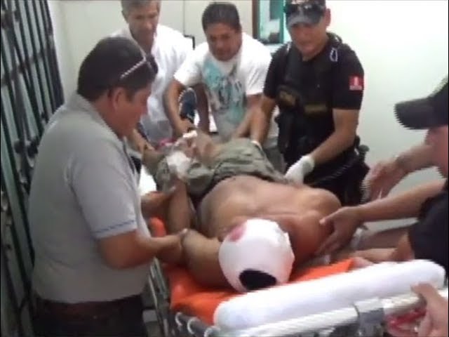 Se complica estado de salud de motociclista que resultó herido en accidente