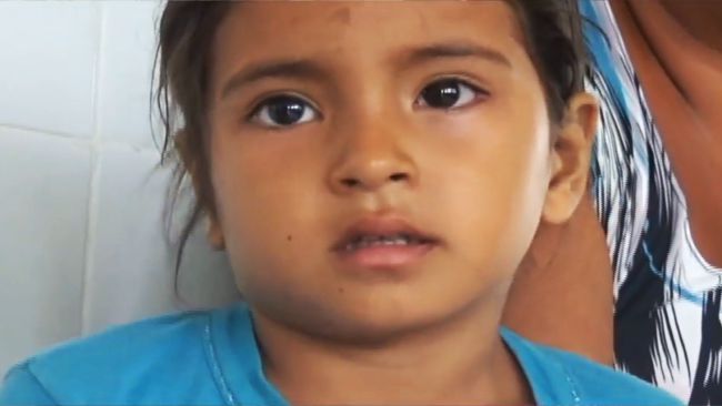 Se incrementa el número de casos de conjuntivitis en la región San Martín Se incrementa el número de casos de conjuntivitis en la región San Martín
