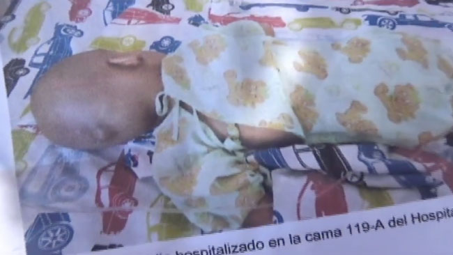 Menor requiere apoyo para su recuperación tras someterse a cirugía Menor requiere apoyo para su recuperación tras someterse a cirugía