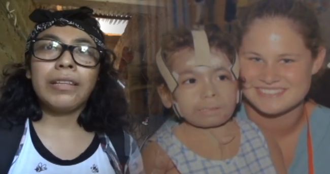 Joven que hace 15 años sufrió quemaduras hoy apoya a ese tipo de ...