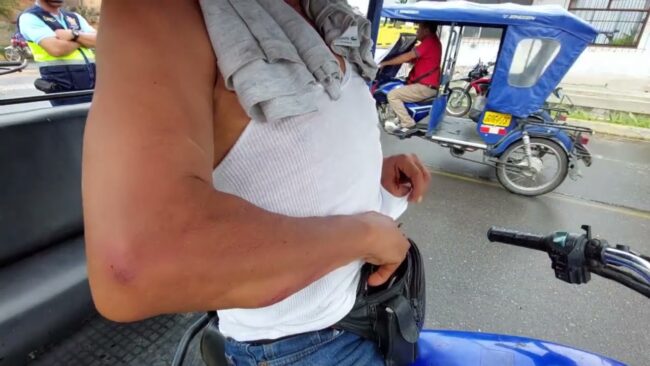 Parroquiano denuncia que pagó a fémina por servicios sexuales y a cambio recibió golpes Parroquiano denuncia que pagó a fémina por servicios sexuales y a cambio recibió golpes