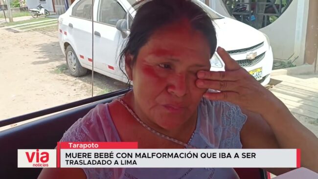 Muere bebé con malformación que iba a ser trasladado a Lima