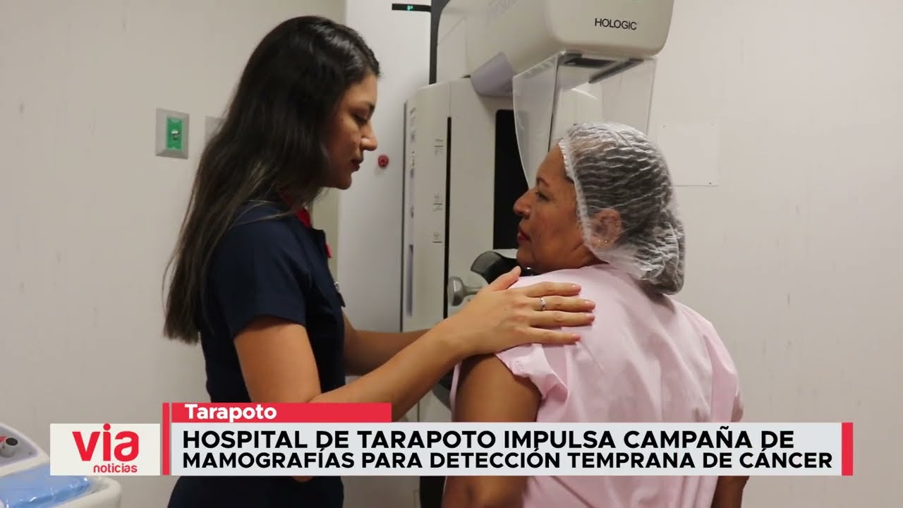 Hospital de Tarapoto impulsa campaña de mamografías para detección temprana de cáncer Hospital de Tarapoto impulsa campaña de mamografías para detección temprana de cáncer