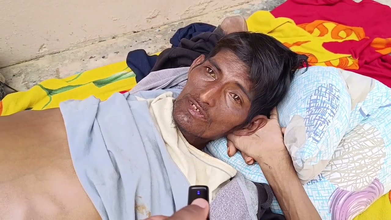 Joven con cirrosis vive postrado en la vía pública y pide ayuda urgente Joven con cirrosis vive postrado en la vía pública y pide ayuda urgente